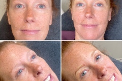 EuroGlam-Microblading-6_221