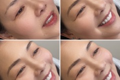 EuroGlam-Microblading-9_211